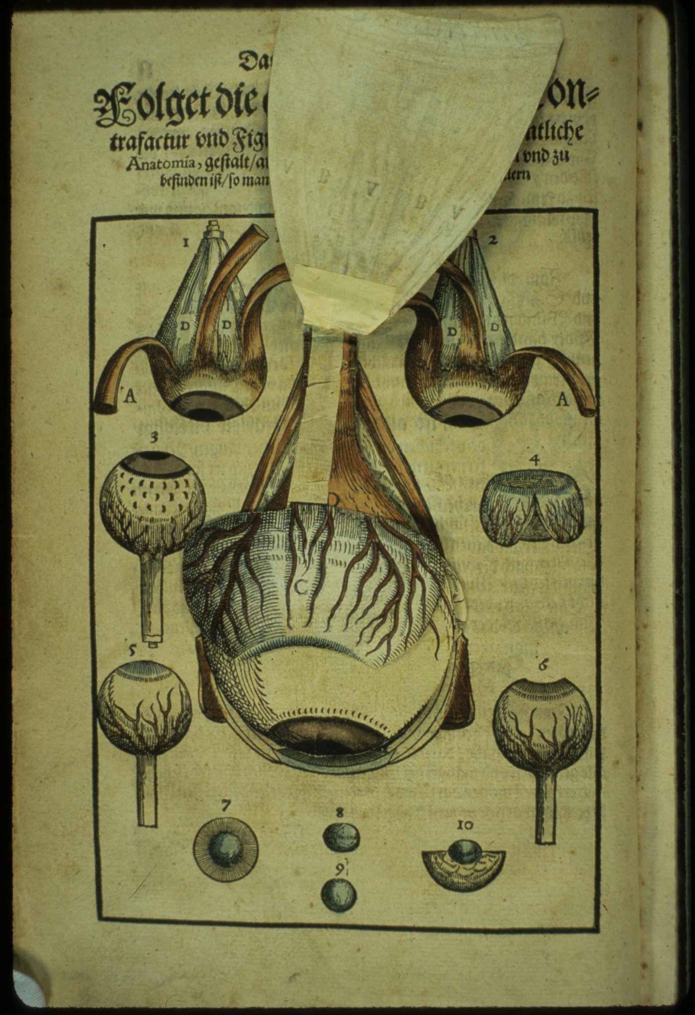 Ophthalmodouleia livre ancien chirurgie oeil ophtalmologie 04 Ophthalmodouleia, manuel dophtalmologie en 1583  technologie histoire design bonus 