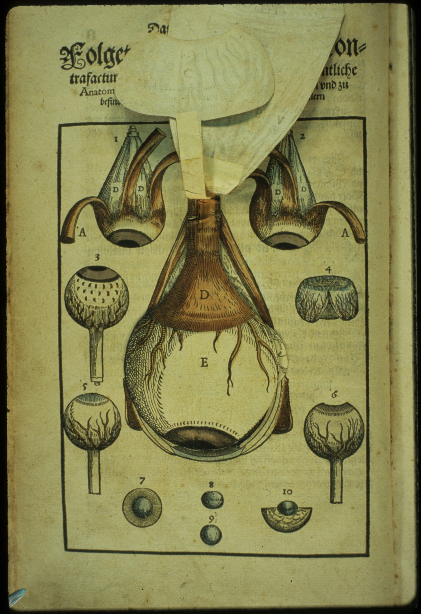 Ophthalmodouleia livre ancien chirurgie oeil ophtalmologie 05 Ophthalmodouleia, manuel dophtalmologie en 1583  technologie histoire design bonus 