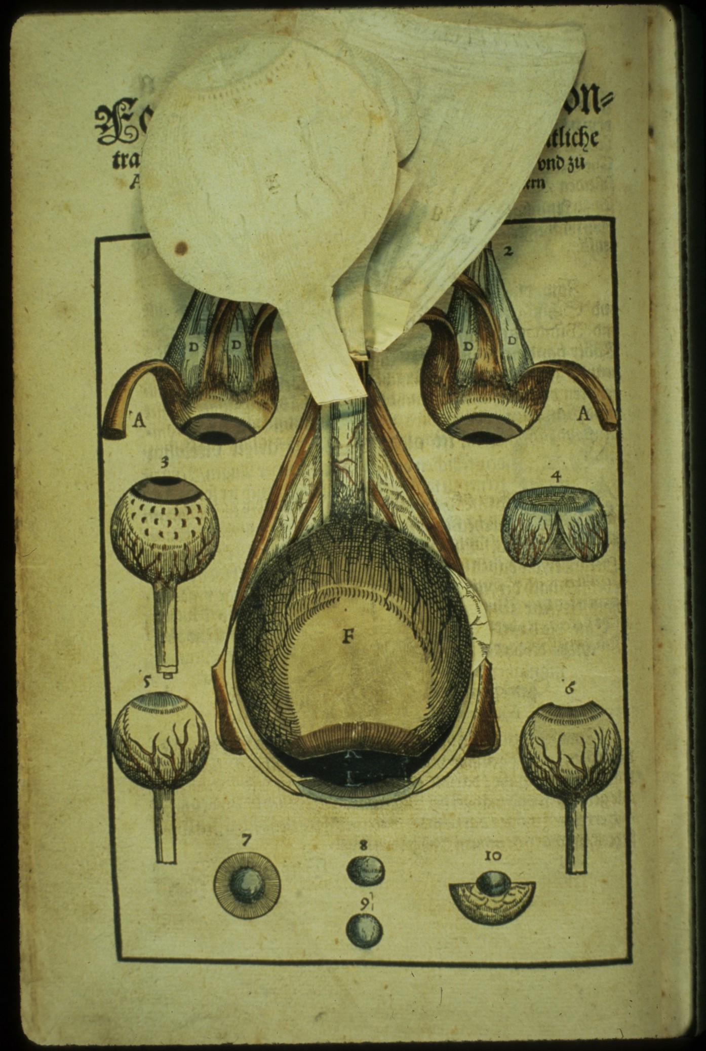 Ophthalmodouleia livre ancien chirurgie oeil ophtalmologie 07 Ophthalmodouleia, manuel dophtalmologie en 1583  technologie histoire design bonus 