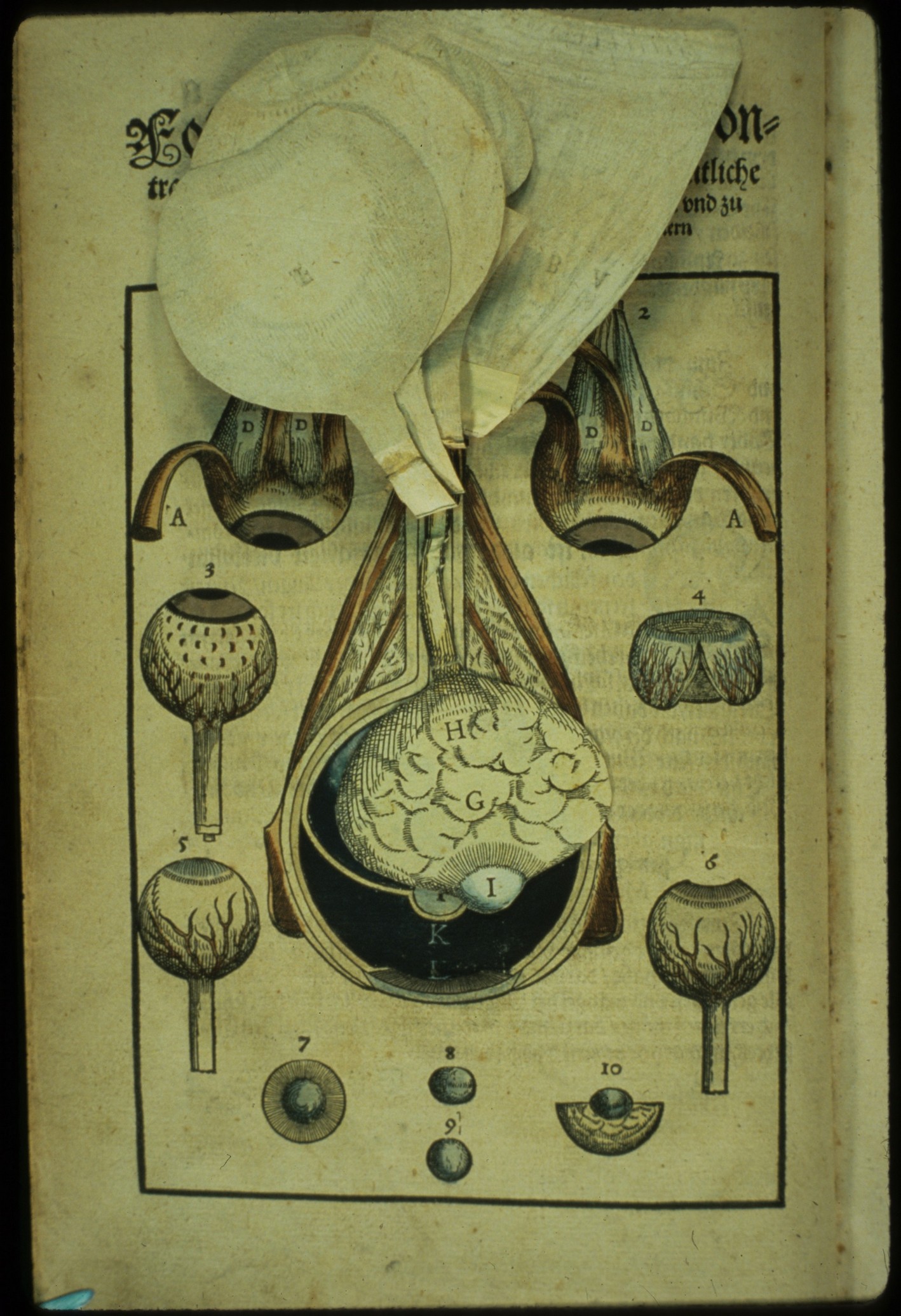 Ophthalmodouleia livre ancien chirurgie oeil ophtalmologie 08 Ophthalmodouleia, manuel dophtalmologie en 1583  technologie histoire design bonus 