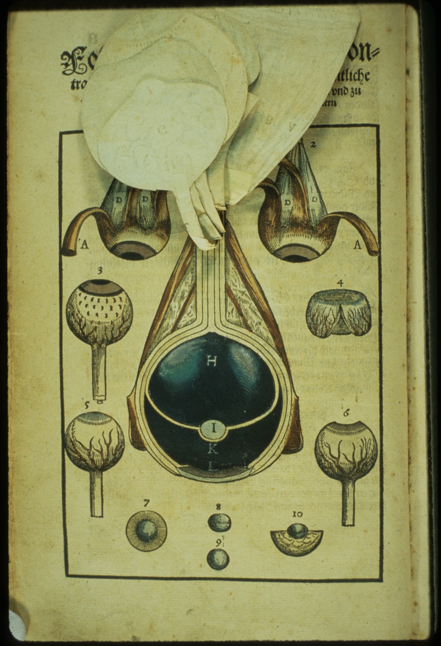 Ophthalmodouleia livre ancien chirurgie oeil ophtalmologie 09 Ophthalmodouleia, manuel dophtalmologie en 1583  technologie histoire design bonus 