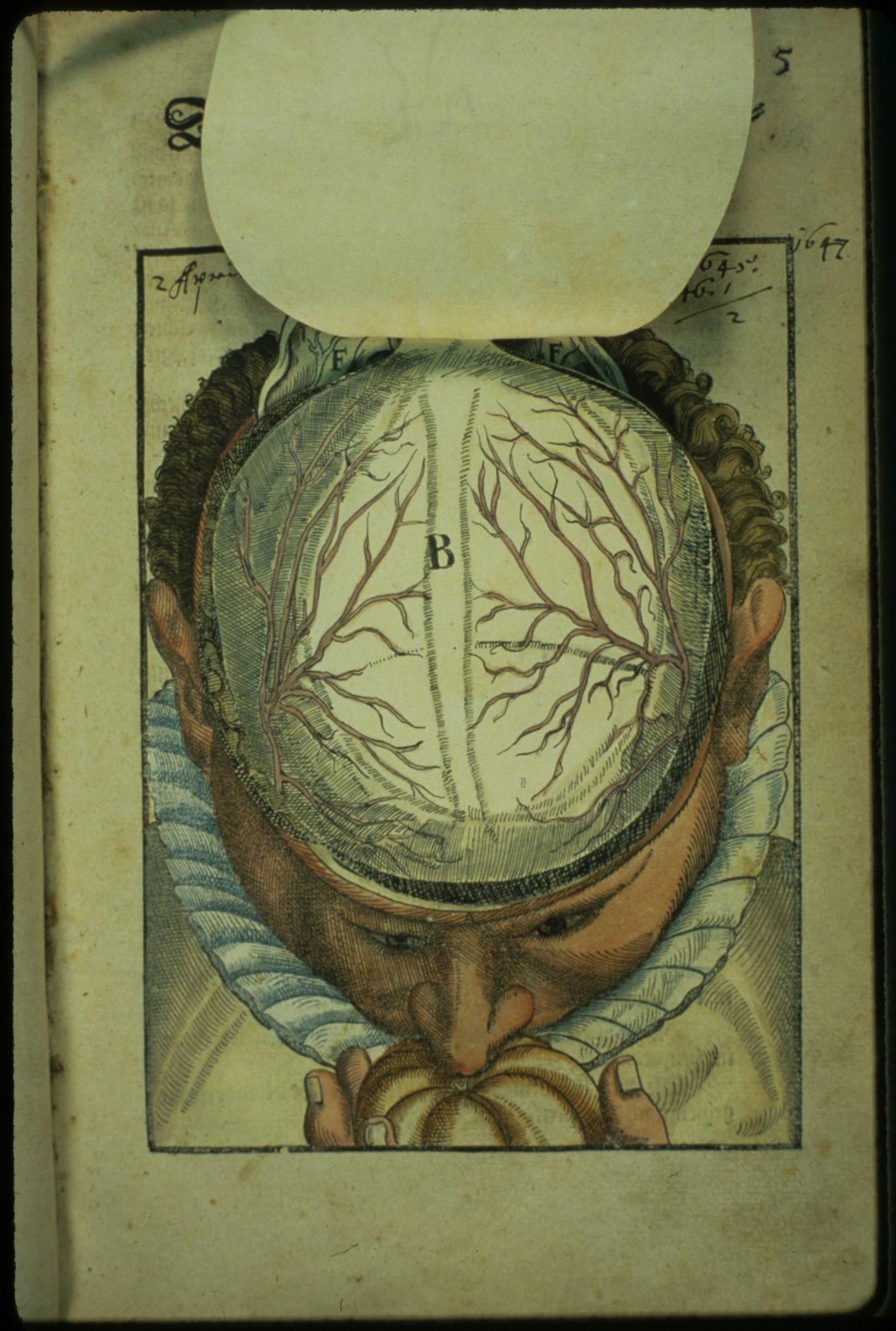 Ophthalmodouleia livre ancien chirurgie oeil ophtalmologie 11 Ophthalmodouleia, manuel dophtalmologie en 1583  technologie histoire design bonus 