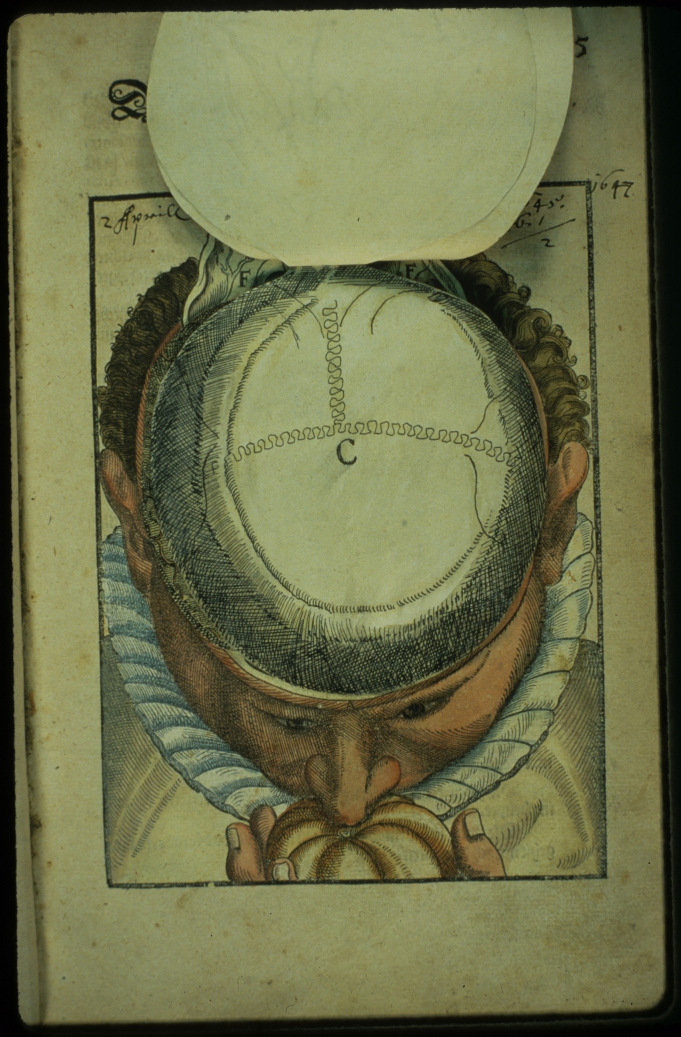 Ophthalmodouleia livre ancien chirurgie oeil ophtalmologie 12 Ophthalmodouleia, manuel dophtalmologie en 1583  technologie histoire design bonus 