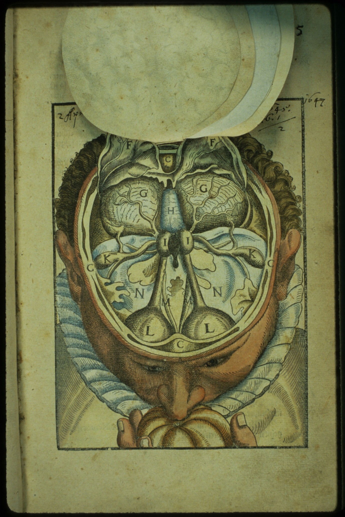 Ophthalmodouleia livre ancien chirurgie oeil ophtalmologie 15 Ophthalmodouleia, manuel dophtalmologie en 1583  technologie histoire design bonus 