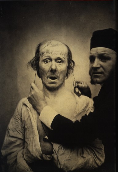 expression-visage-electricite-Duchenne-Boulogne-01