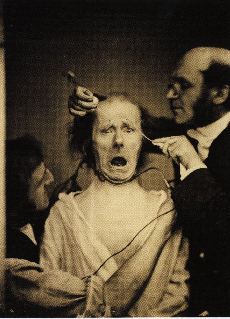 Les expressions électriques du visage par Duchenne de Boulogne expression visage electricite Duchenne Boulogne 03 expression visage electricite Duchenne Boulogne 03 Les expressions électriques du visage par Duchenne de Boulogne technologie photographie histoire featured