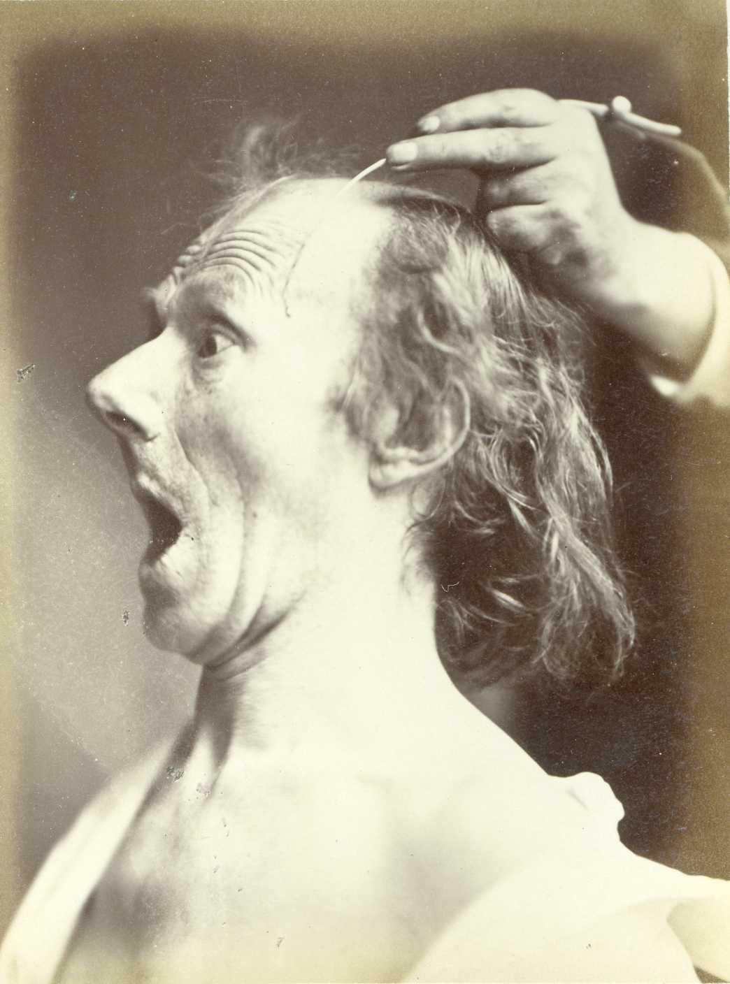 Les expressions électriques du visage par Duchenne de Boulogne expression visage electricite Duchenne Boulogne 07 expression visage electricite Duchenne Boulogne 07 Les expressions électriques du visage par Duchenne de Boulogne technologie photographie histoire featured