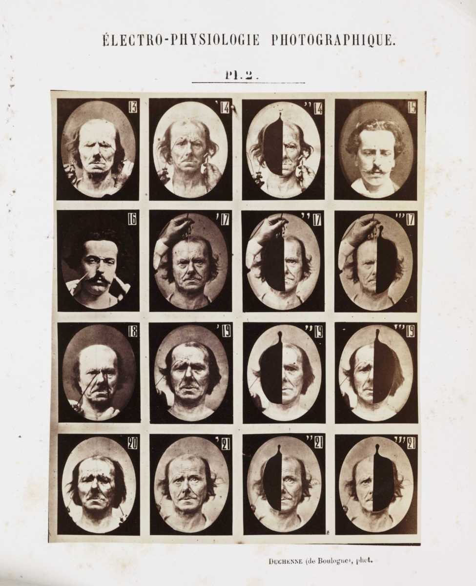 Les expressions électriques du visage par Duchenne de Boulogne expression visage electricite Duchenne Boulogne 08 expression visage electricite Duchenne Boulogne 08 Les expressions électriques du visage par Duchenne de Boulogne technologie photographie histoire featured