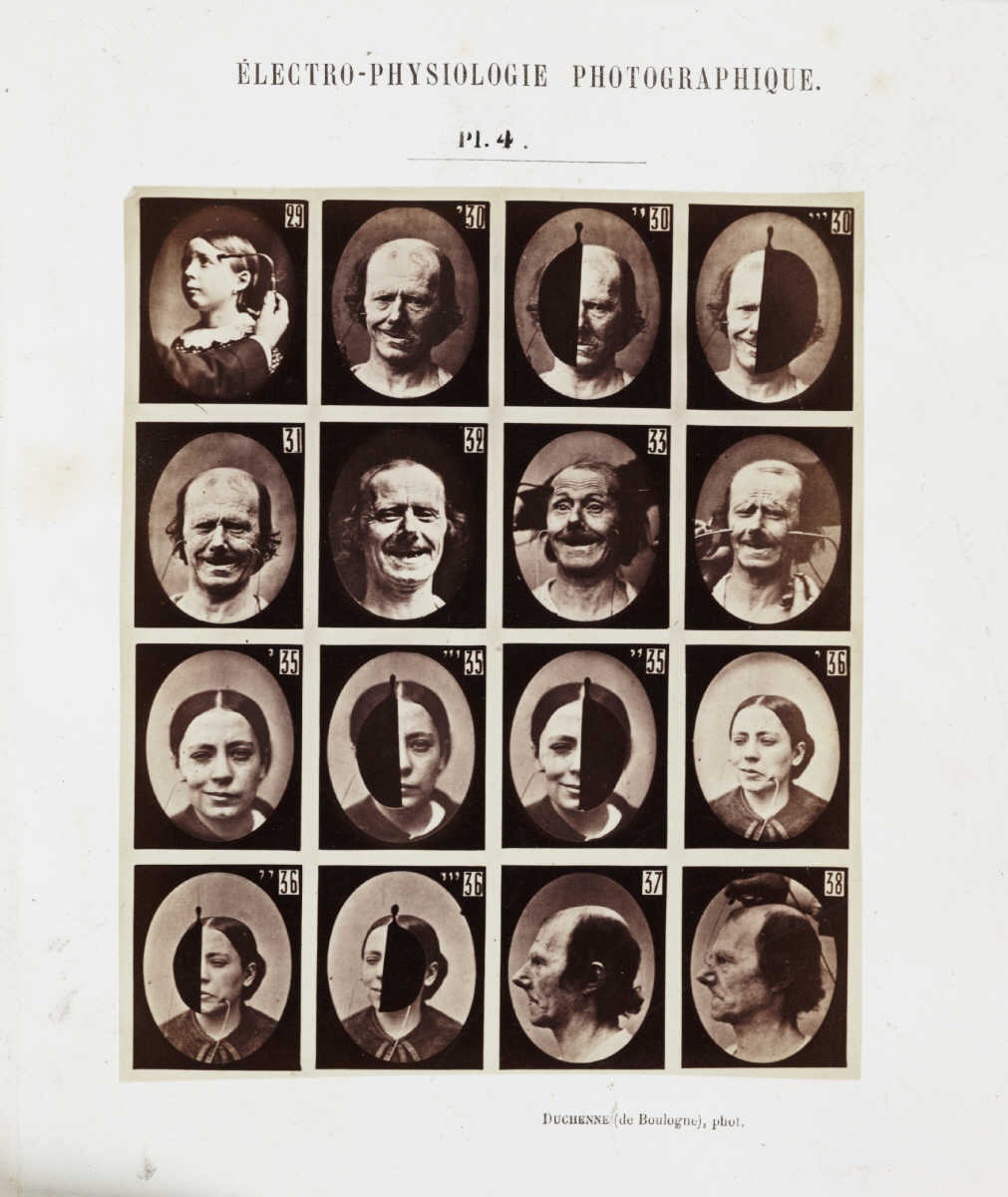 Les expressions électriques du visage par Duchenne de Boulogne expression visage electricite Duchenne Boulogne 09 expression visage electricite Duchenne Boulogne 09 Les expressions électriques du visage par Duchenne de Boulogne technologie photographie histoire featured