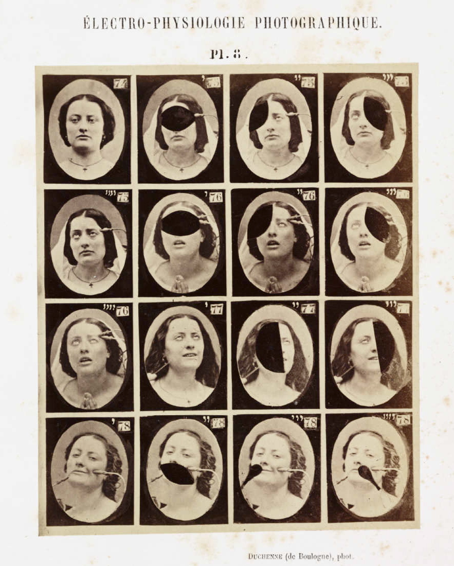Les expressions électriques du visage par Duchenne de Boulogne expression visage electricite Duchenne Boulogne 12 expression visage electricite Duchenne Boulogne 12 Les expressions électriques du visage par Duchenne de Boulogne technologie photographie histoire featured