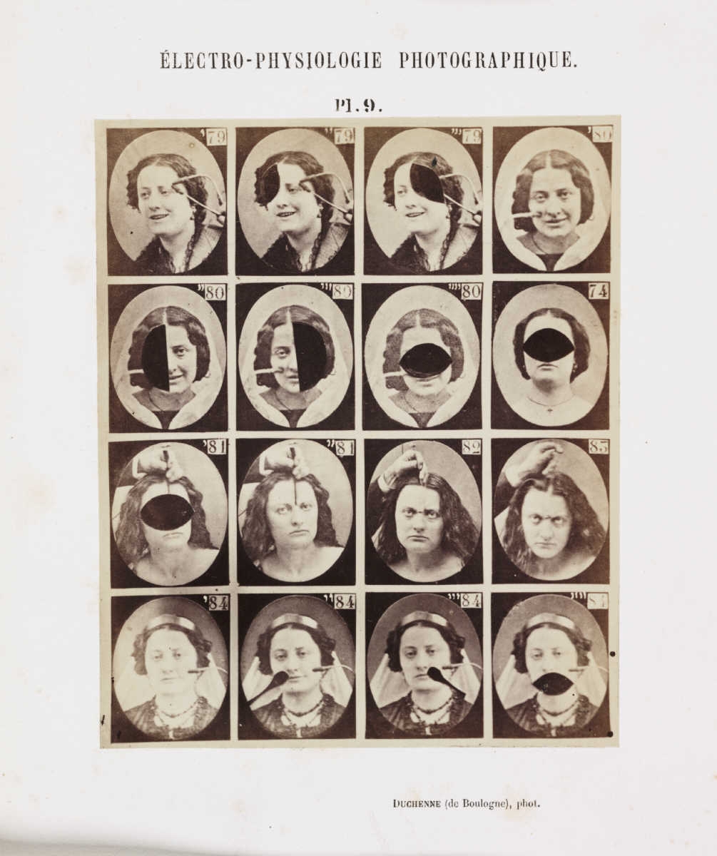 Les expressions électriques du visage par Duchenne de Boulogne expression visage electricite Duchenne Boulogne 13 expression visage electricite Duchenne Boulogne 13 Les expressions électriques du visage par Duchenne de Boulogne technologie photographie histoire featured