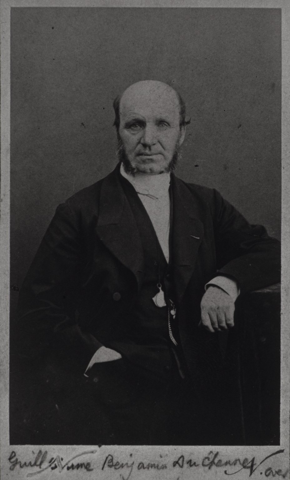 Les expressions électriques du visage par Duchenne de Boulogne expression visage electricite Duchenne Boulogne 14 expression visage electricite Duchenne Boulogne 14 Les expressions électriques du visage par Duchenne de Boulogne technologie photographie histoire featured