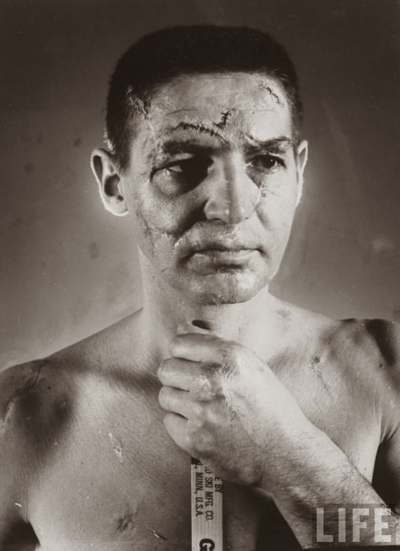 Terry Sawchuk The face of a hockey goalie before masks became standard game equipment, 1966