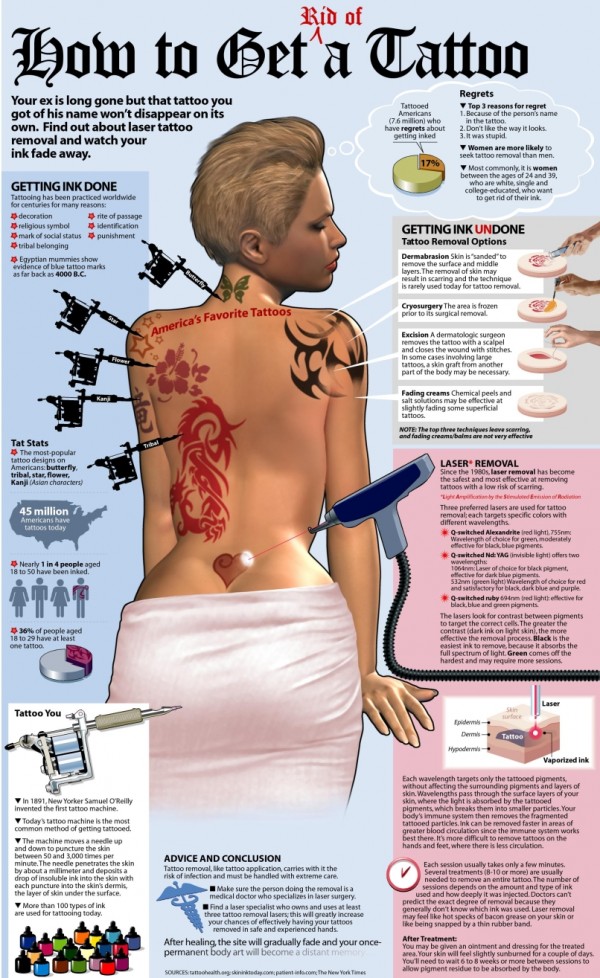 Comment effacer un tatouage