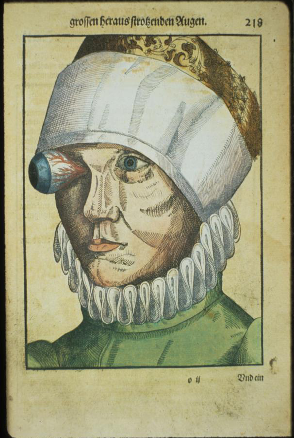 Ophthalmodouleia, manuel d’ophtalmologie en 1583