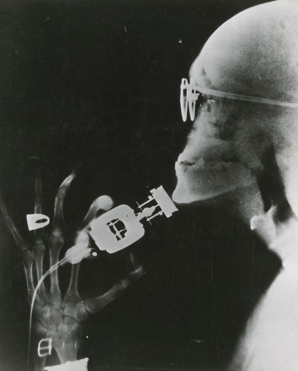 Démonstration d’un rasoir électrique avec des rayons X en 1924