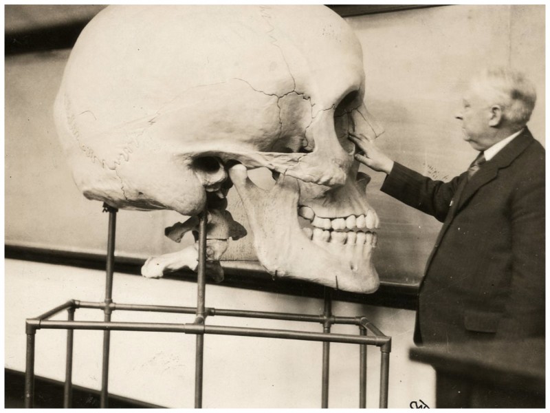 [Mystère #101] Un crâne géant pour un cours d’anatomie à Havard