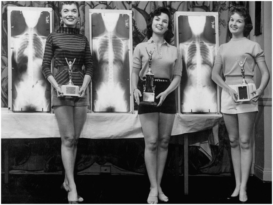 [Mystère #117]  Miss meilleure posture 1956