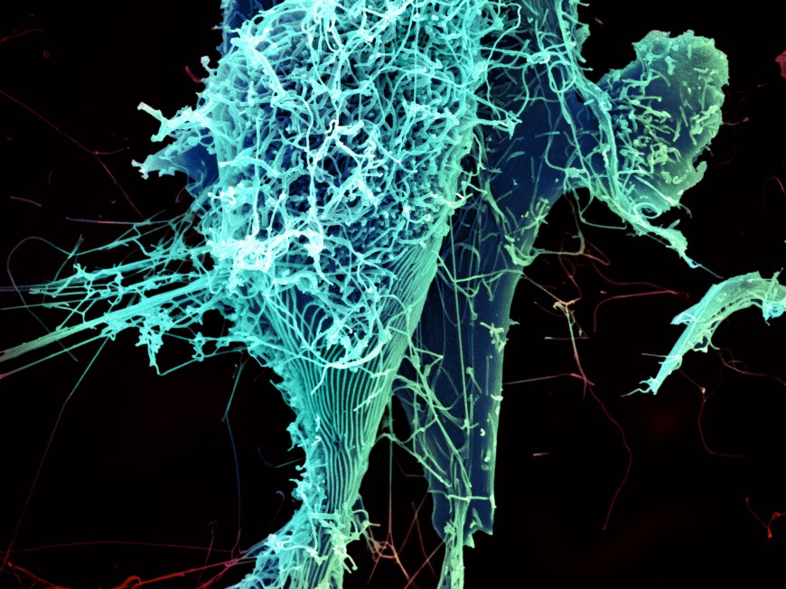 Le virus Ebola au microscope