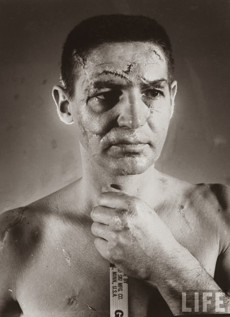 Terry Sawchuk The face of a hockey goalie before masks became standard game  equipment, 1966 – La boite verte