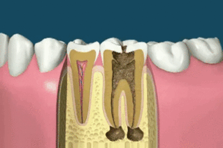 best-of-gif6-animation-25