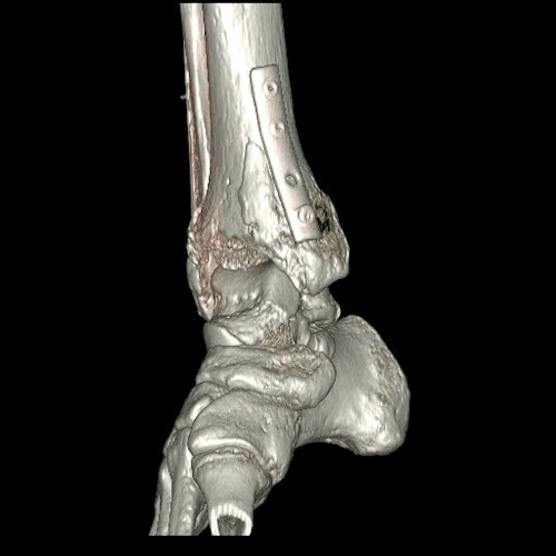 progres-imagerie-medicale-02