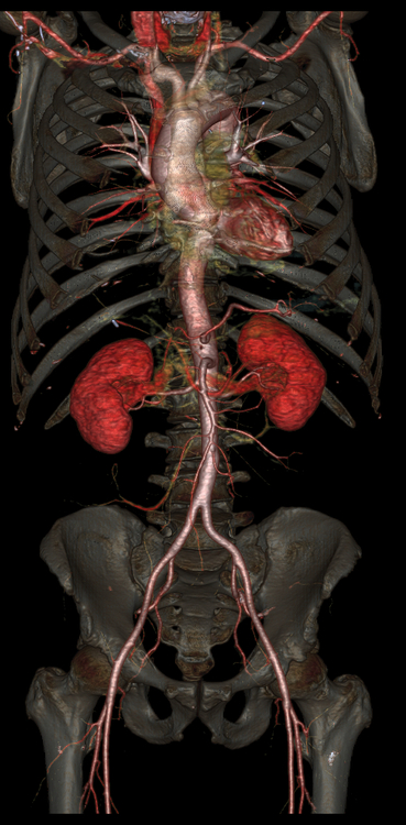 progres-imagerie-medicale-04