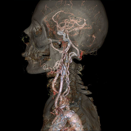 progres-imagerie-medicale-08