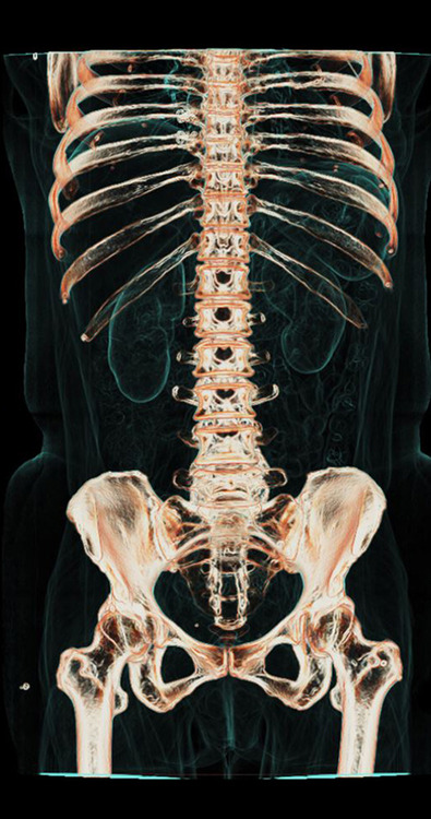 progres-imagerie-medicale-09