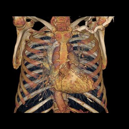 progres-imagerie-medicale-10