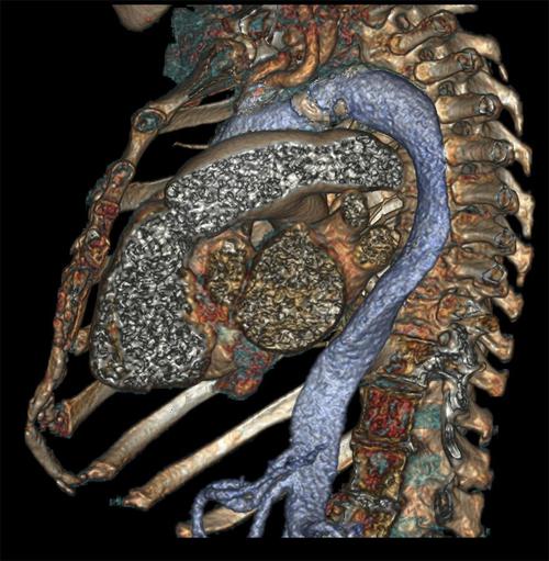progres-imagerie-medicale-12