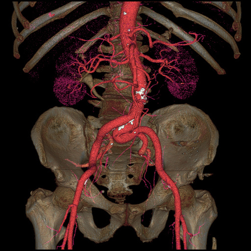 progres-imagerie-medicale-13