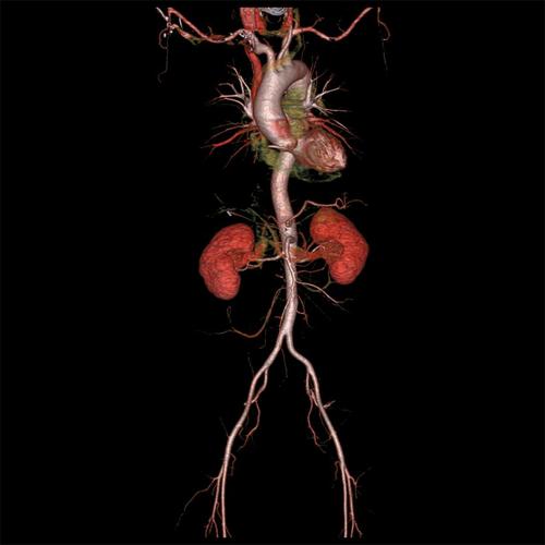 progres-imagerie-medicale-14