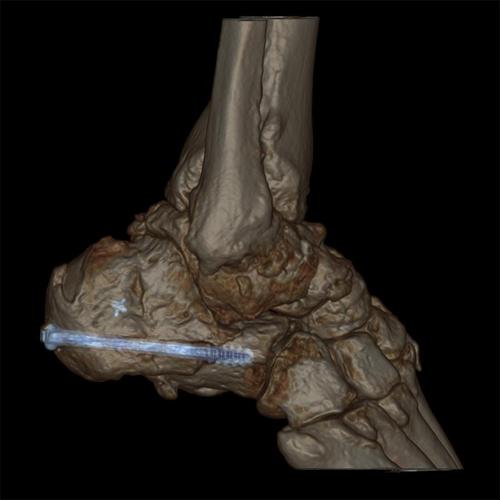 progres-imagerie-medicale-15