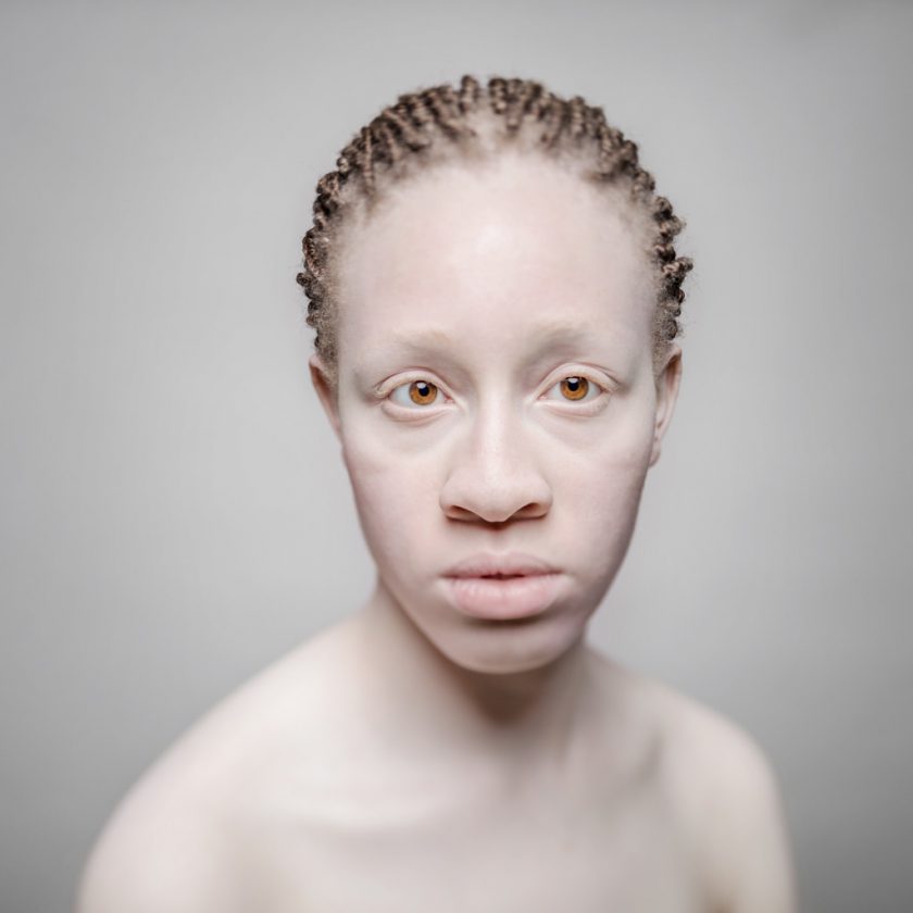 AlbinosAliceLeveque-2-1024x1024