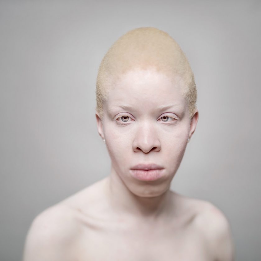 AlbinosAliceLeveque-3-1024x1024