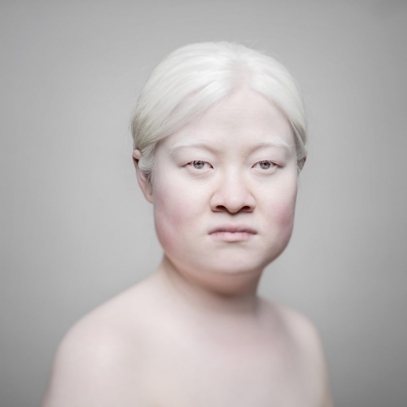 AlbinosAliceLeveque-4-1024x1024