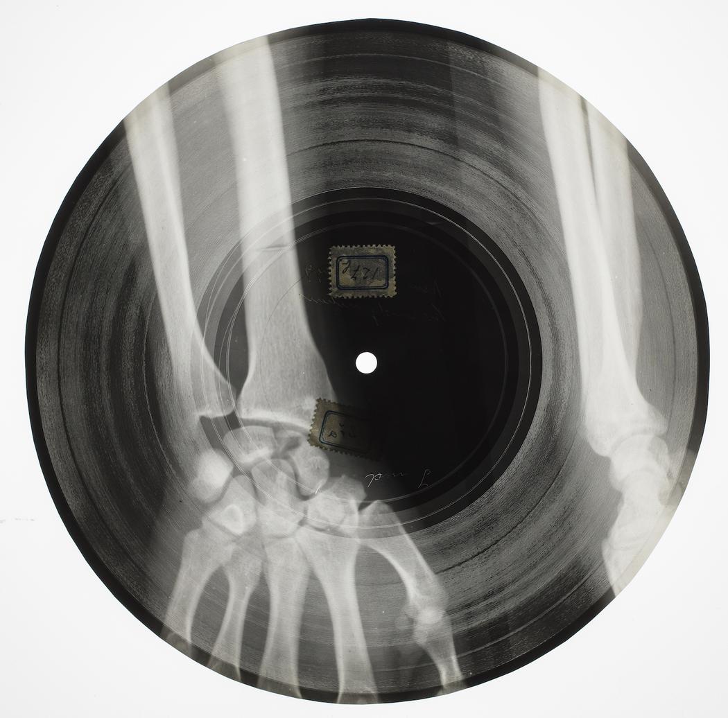 Les vinyls sur radiographies en Russie